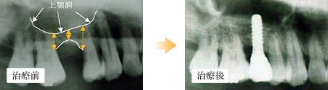 治療前 治療後