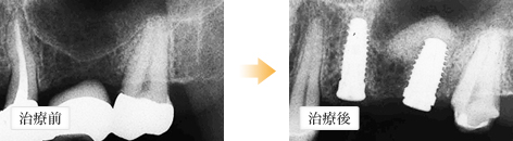 治療前 治療後