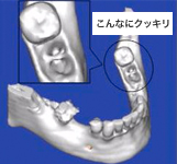 こんなにクッキリ