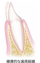 健康的な歯周組織