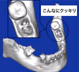 こんなにクッキリ