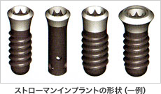 ストローマンインプラントの形状（一例）